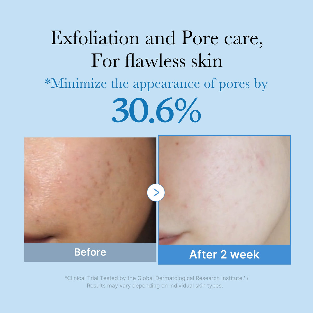 zero-pore-toner-q6 01_d6480b4e-3c08-4954-994a-ed5212c1839c.jpg
