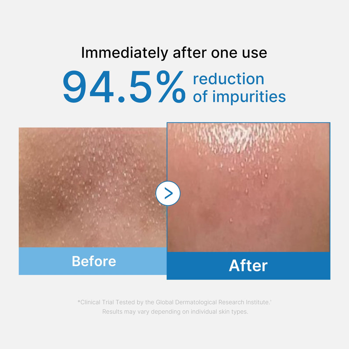 zero-pore-blackhead-deep-cleansing-oil-w4 01_eed557ec-5857-46a2-8b17-dbd67c692dcb.jpg