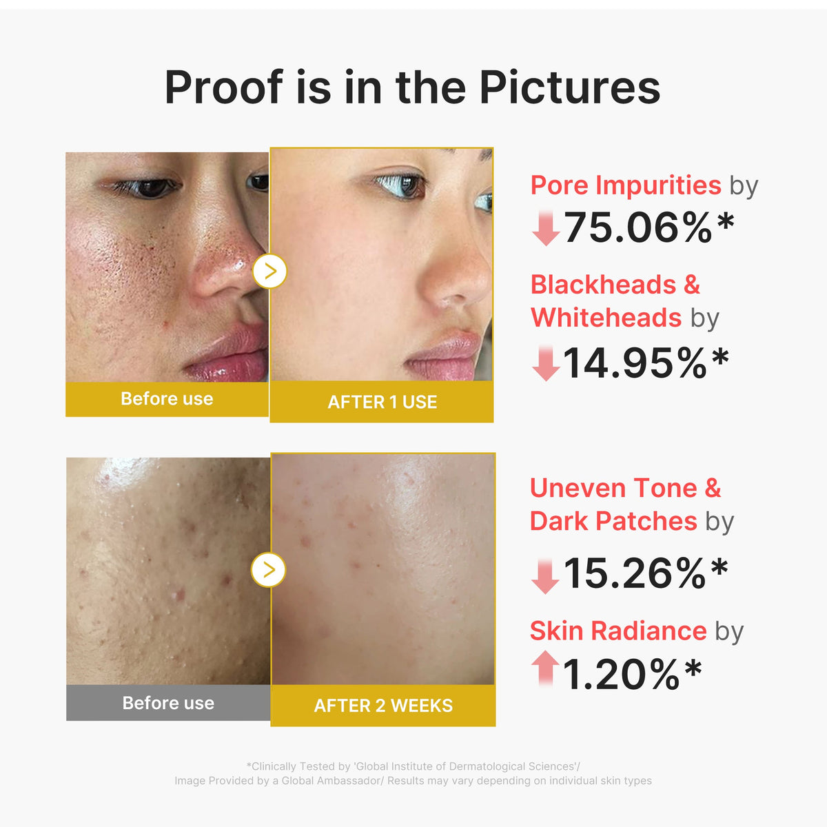 kojic-acid-turmeric-peel-shot-d5 02_45fe66d3-b3f6-4100-aa52-2afd7eded417.jpg