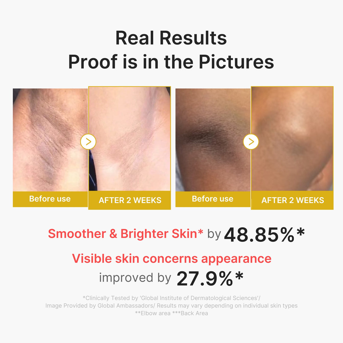 kojic-acid-turmeric-body-peel-shot-d3 02_72880cfc-382b-440b-8152-7e3dce87da2a.jpg