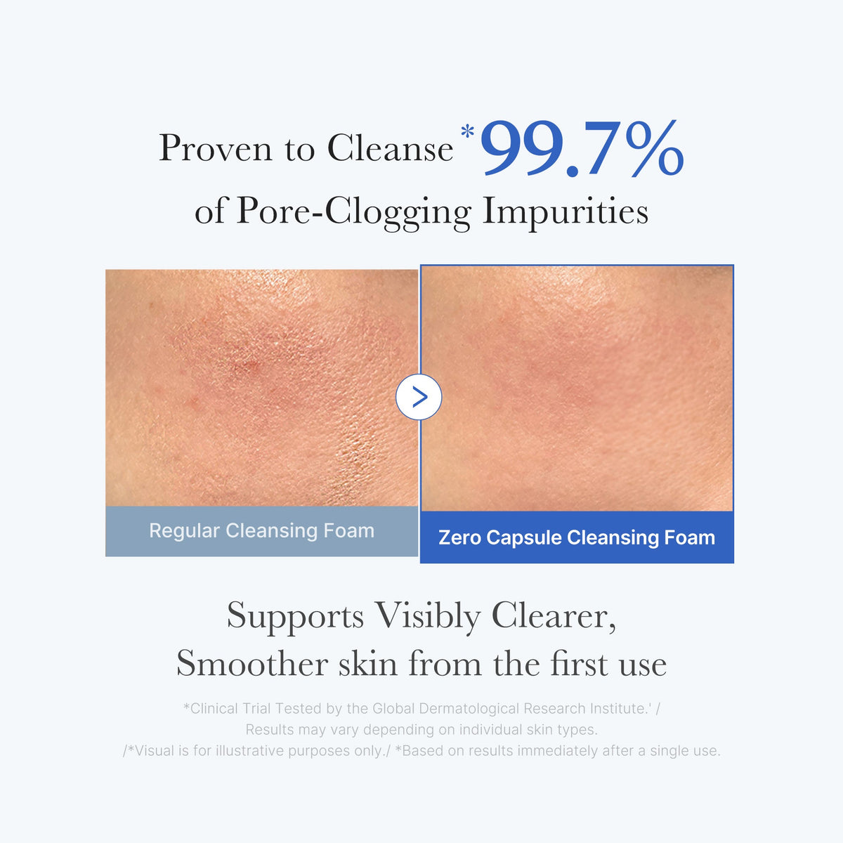 zero-pore-capsule-cleansing-foam-g8 02_c1fb9dfb-86c5-4038-8ff8-490d1006276c.jpg