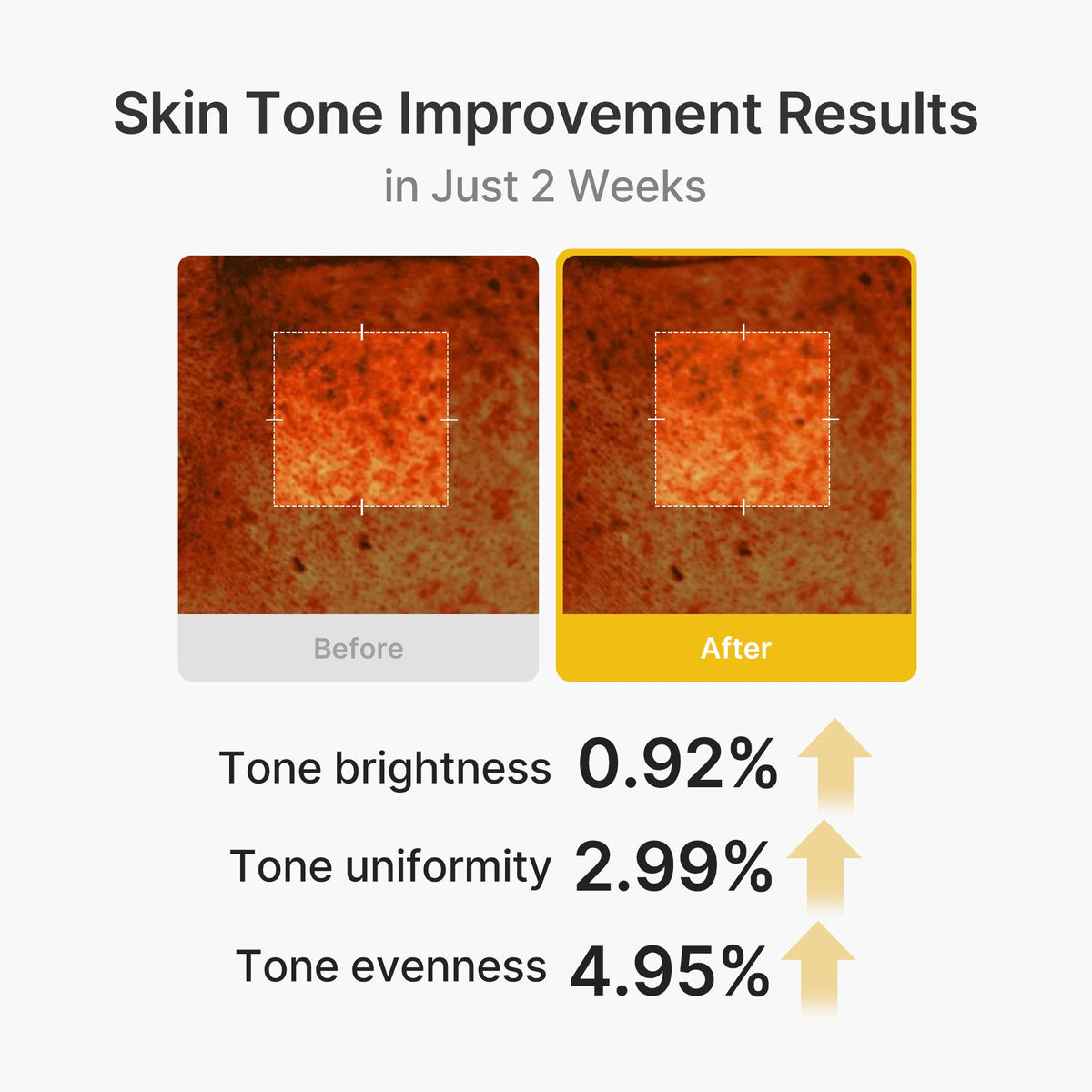 kojic-acid-turmeric-vita-capsule-cream-y8 03_2b626701-fc6c-4702-9e96-a2157a4f7f9d.jpg