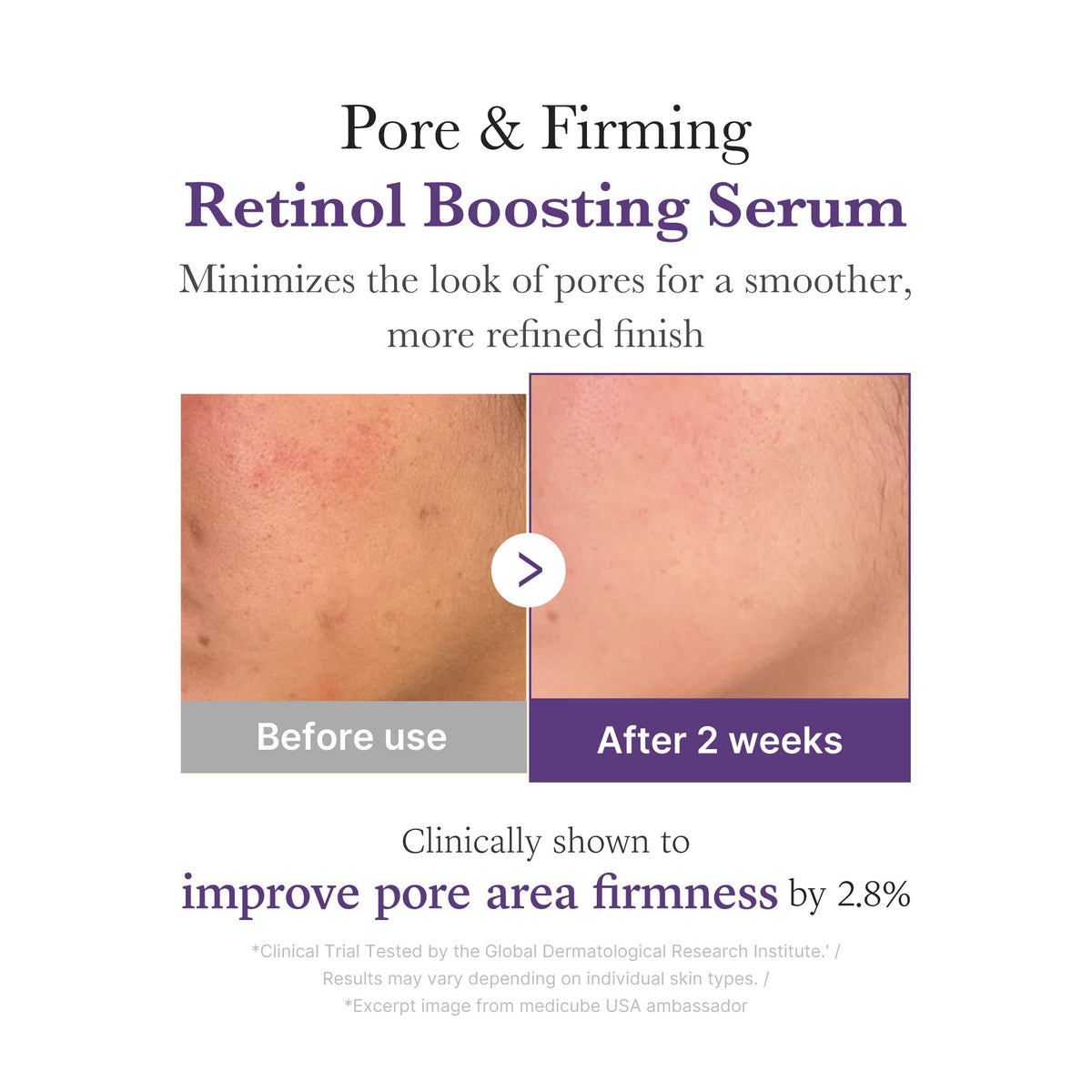retinol-nmn-boosting-serum-n1 03_3510e7a5-5633-4a18-81ea-1389593bd517.jpg