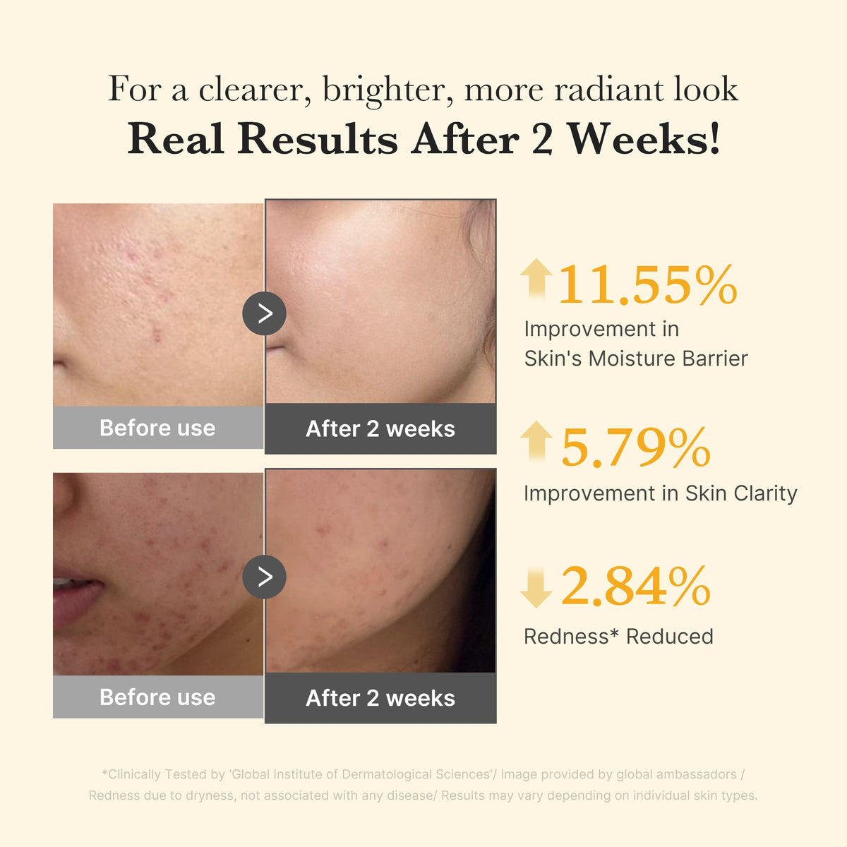 kojic-acid-turmeric-capsule-serum-r1 03_436487f5-76df-490e-8a61-01118373efbd.jpg