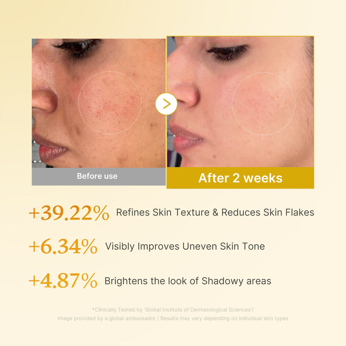 kojic-acid-turmeric-toner-r5 03_b7578d52-4c93-4407-9c6c-7cb230c85b06.jpg