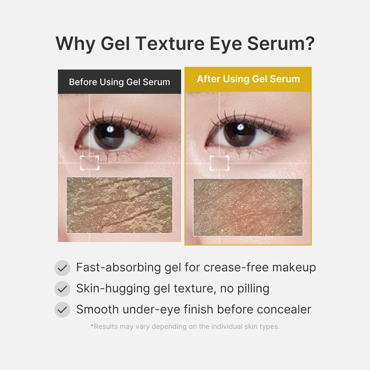 kojic-acid-tumeric-eye-gel-serum-y0 04_0487ef36-49f4-4294-8049-bb55118b05fe.jpg