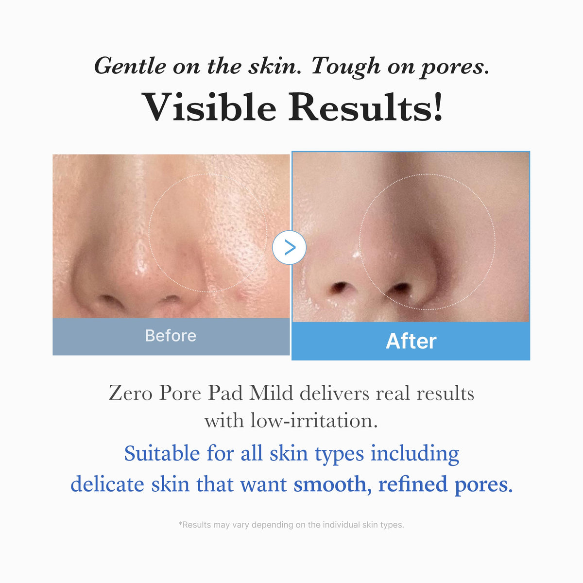 zero-pore-madecassoside-pads-mild-a1 04_6357f9f9-483b-4891-82c6-a58d336e62c8.jpg