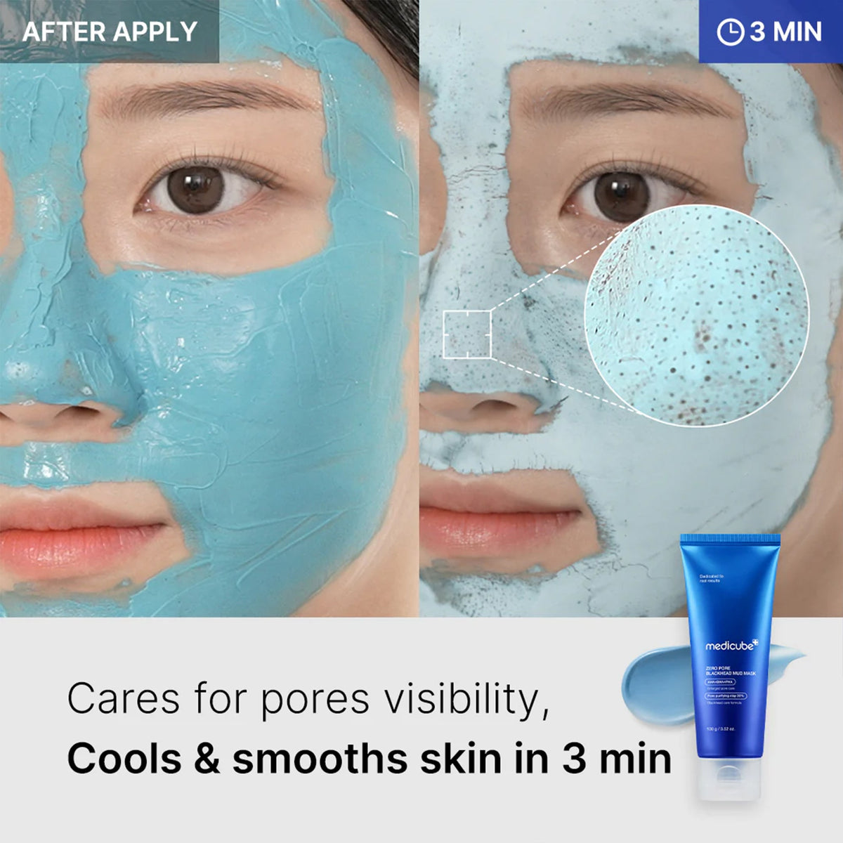 zero-pore-blackhead-mud-mask-l5 04_867c0459-a94e-40d3-bd9a-70400edabe8d.jpg