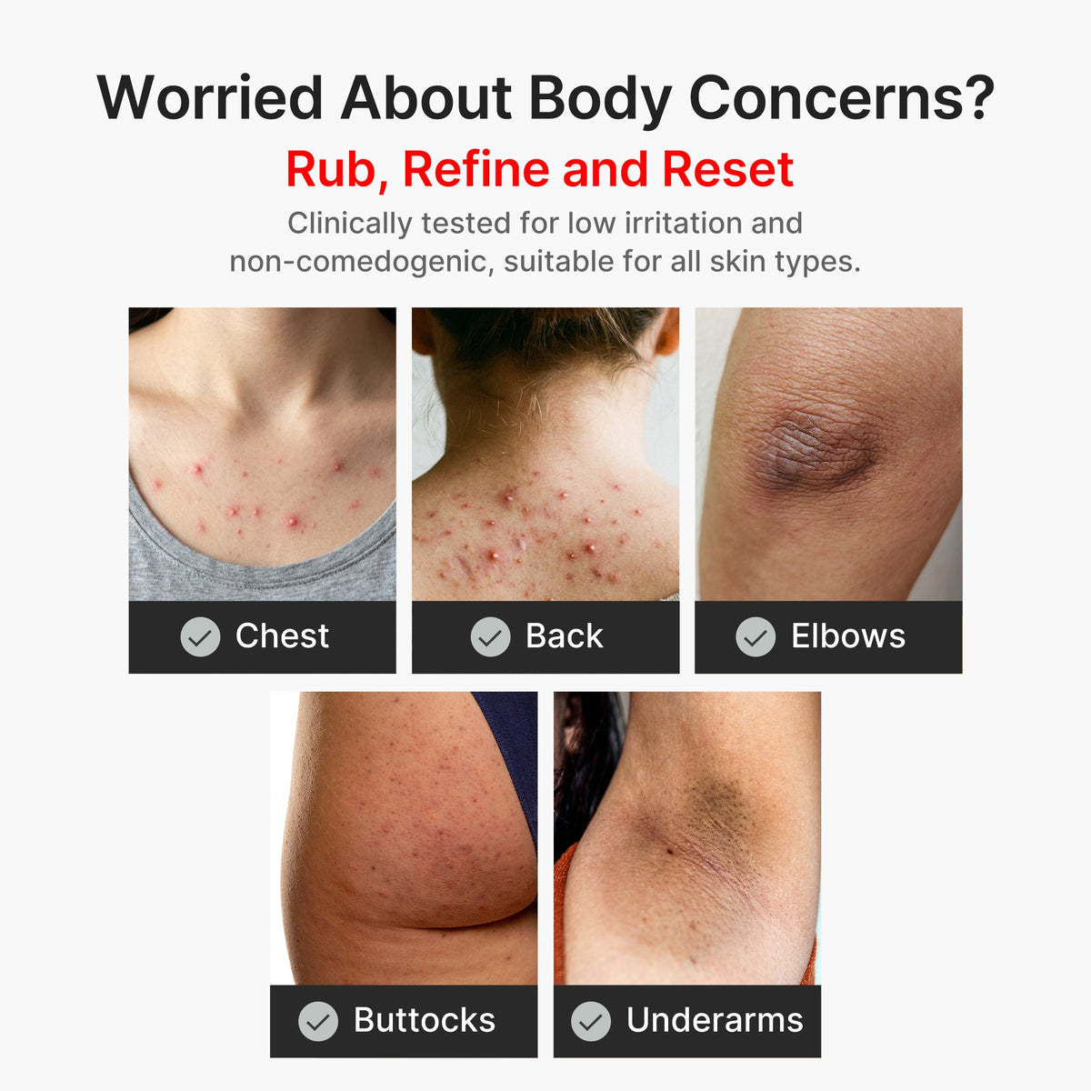 kojic-acid-turmeric-body-peel-shot-d3 04_8a7237f2-3ebf-401e-bd85-54841aeb3efc.jpg