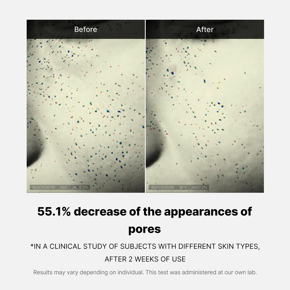 pore-care-duo-d5 05_12ddab8a-64be-4612-8ee1-27e5ec701921.jpg
