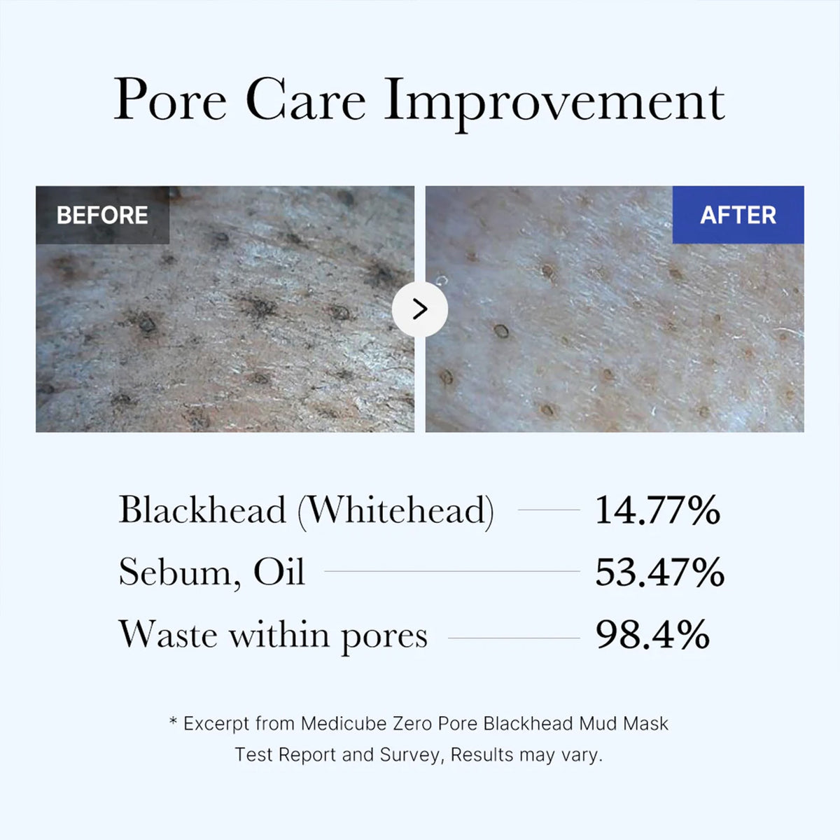 zero-pore-blackhead-mud-mask-l5 05_9362a158-c2b3-4525-acc0-631a2cfdea47.jpg