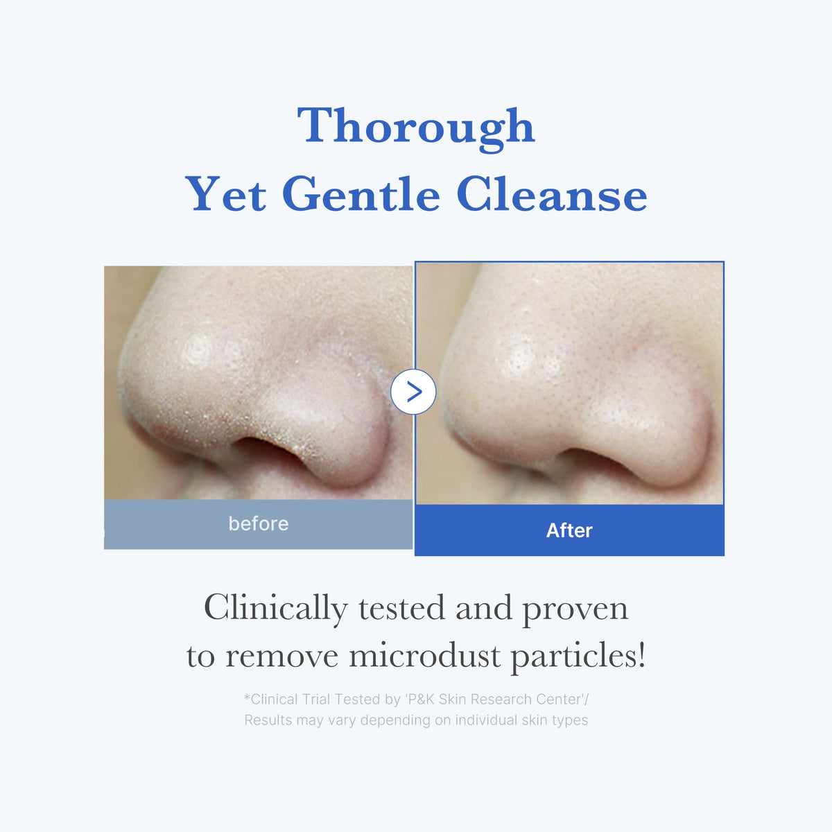 zero-foam-cleanser-q7 250702_ZeroCleanser3.jpg