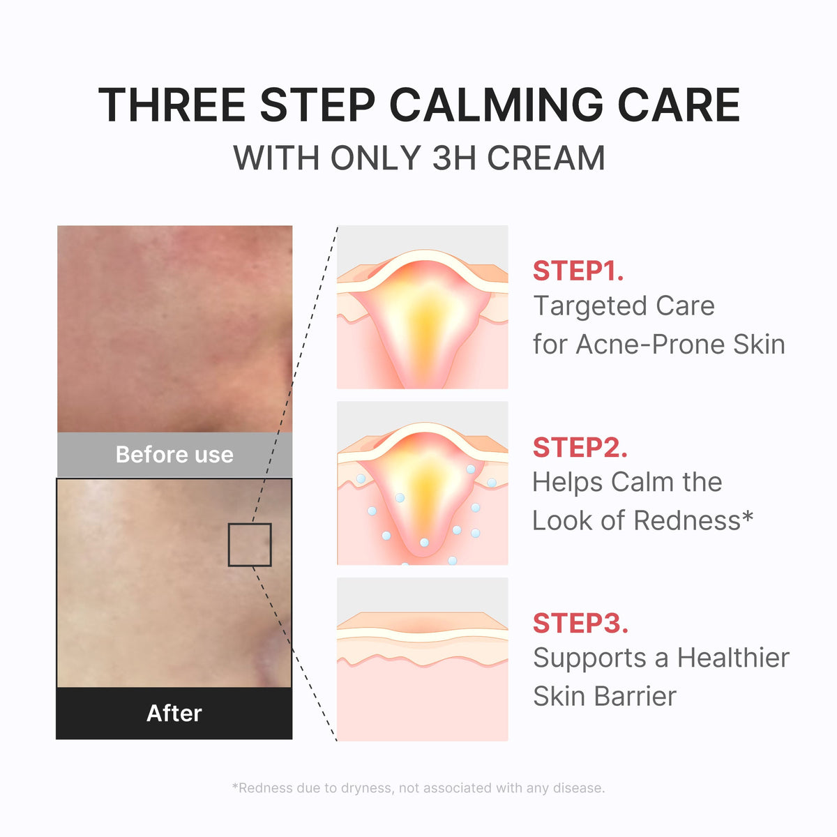 3h-daily-relief-cream-t7 3H_04.jpg