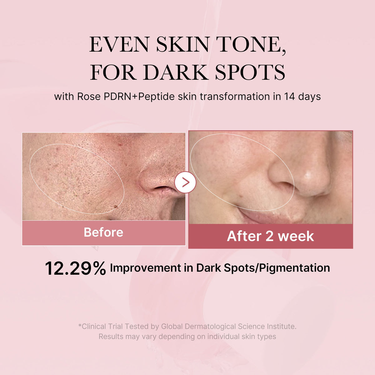 pdrn-pink-peptide-toner-p8 PDRN_01_308c518e-5ac6-4e54-99bd-eabc8796739b.jpg