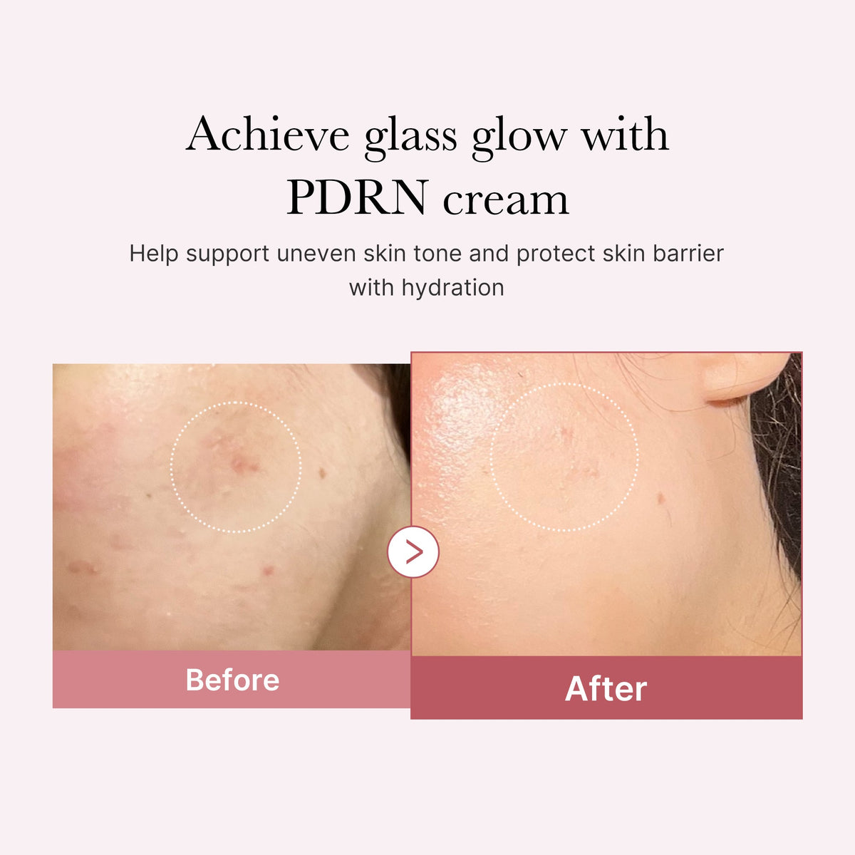 pdrn-pink-peptide-cream-e7 PDRN_02_d7805bfe-cf43-446a-b71b-a276683f136b.jpg