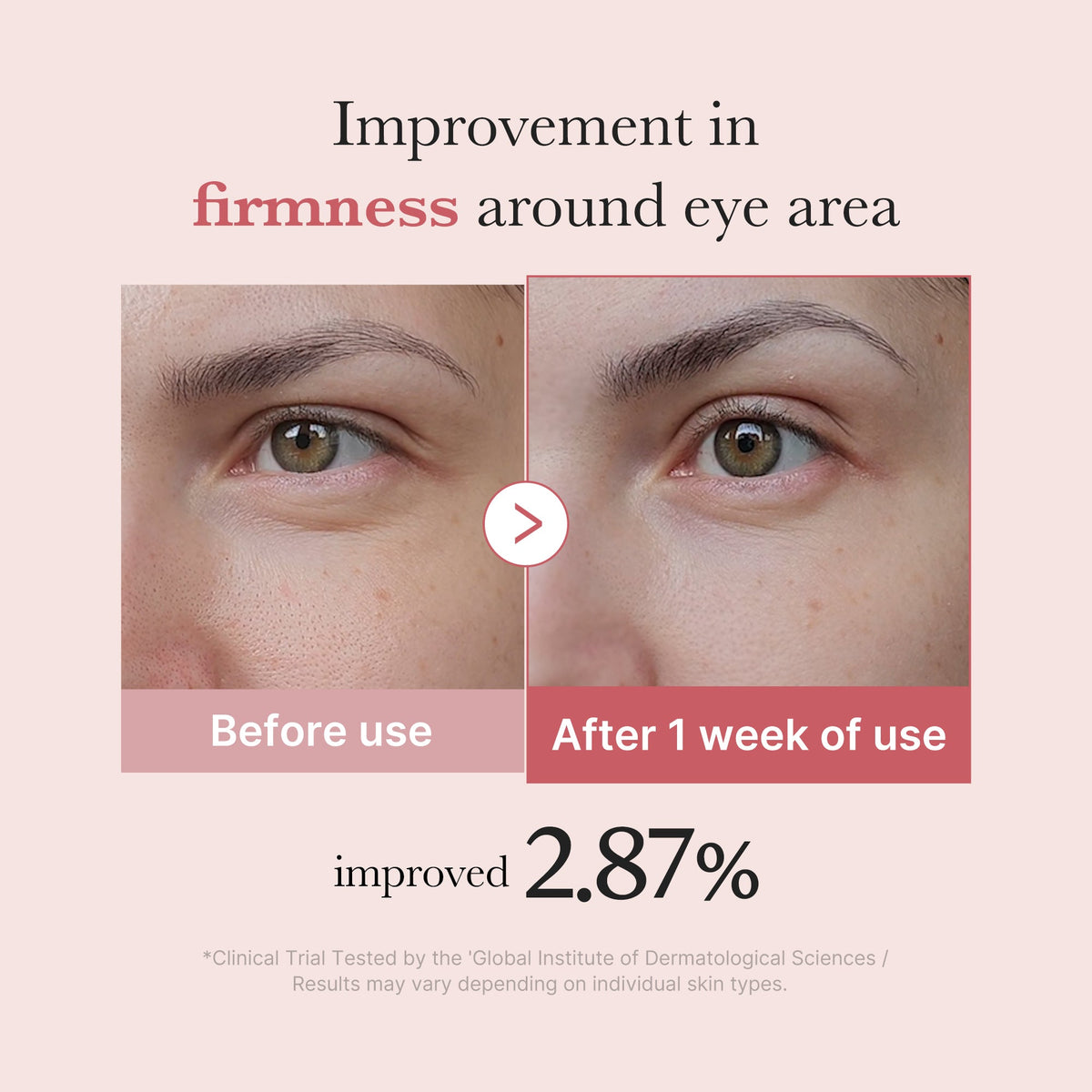 pdrn-pink-peptide-eye-cream-s4 PDRN_03_256dd753-0a2f-41b4-b3cd-bbfd3bc27018.jpg