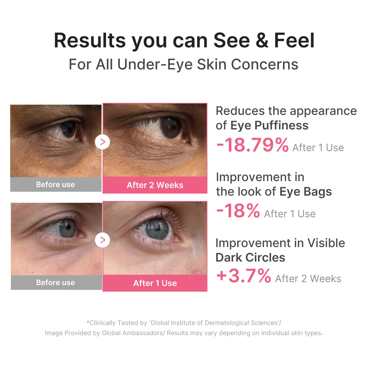 pdrn-caffeine-collagen-eye-patch-p7 PDRN_03_cdce2143-b8d8-43cb-ac69-fcbdf6640249.jpg
