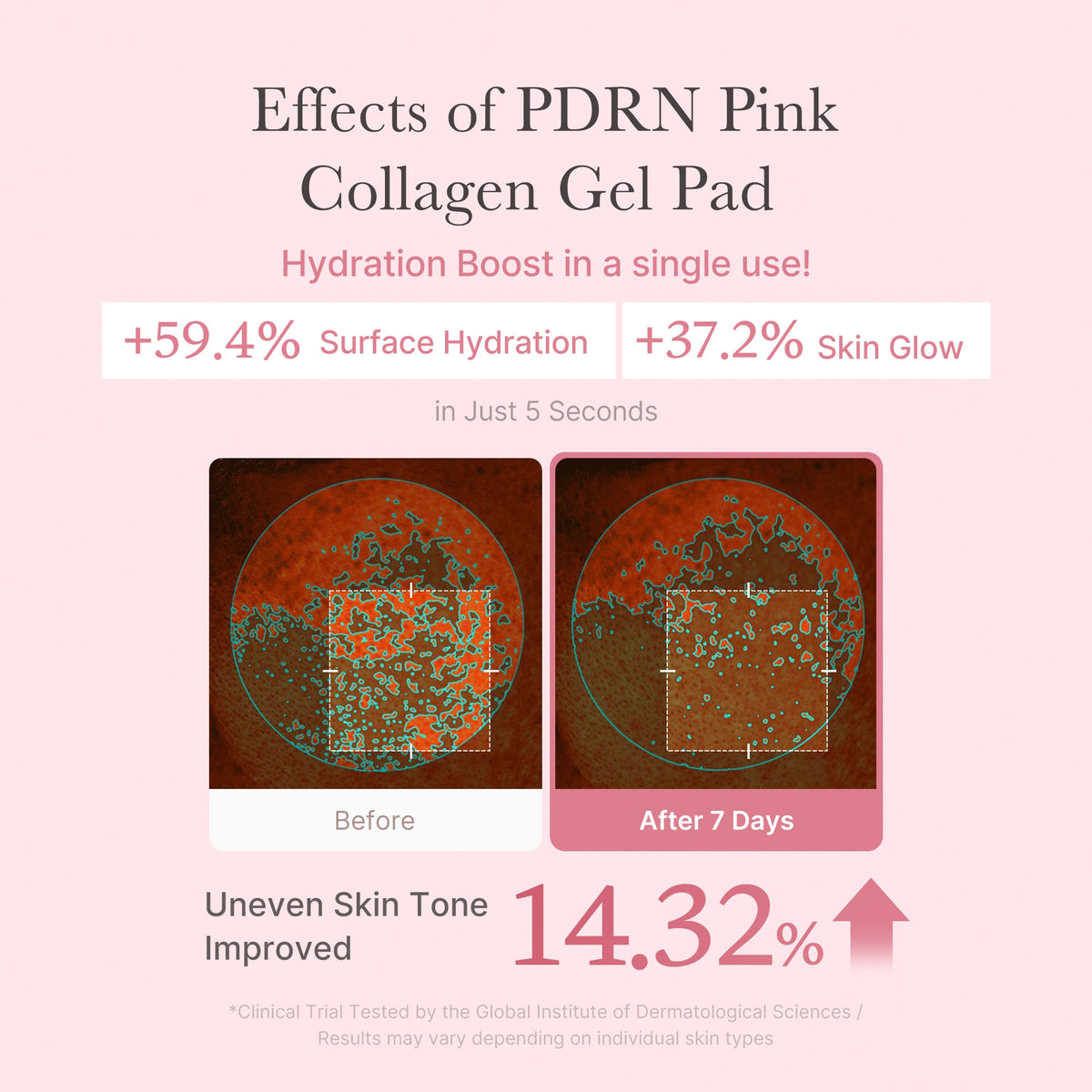 pdrn-pink-collagen-gel-toner-pad-h8 PDRN_04_f9a16a56-8d9e-4c47-a635-ed34ec3ed571.jpg