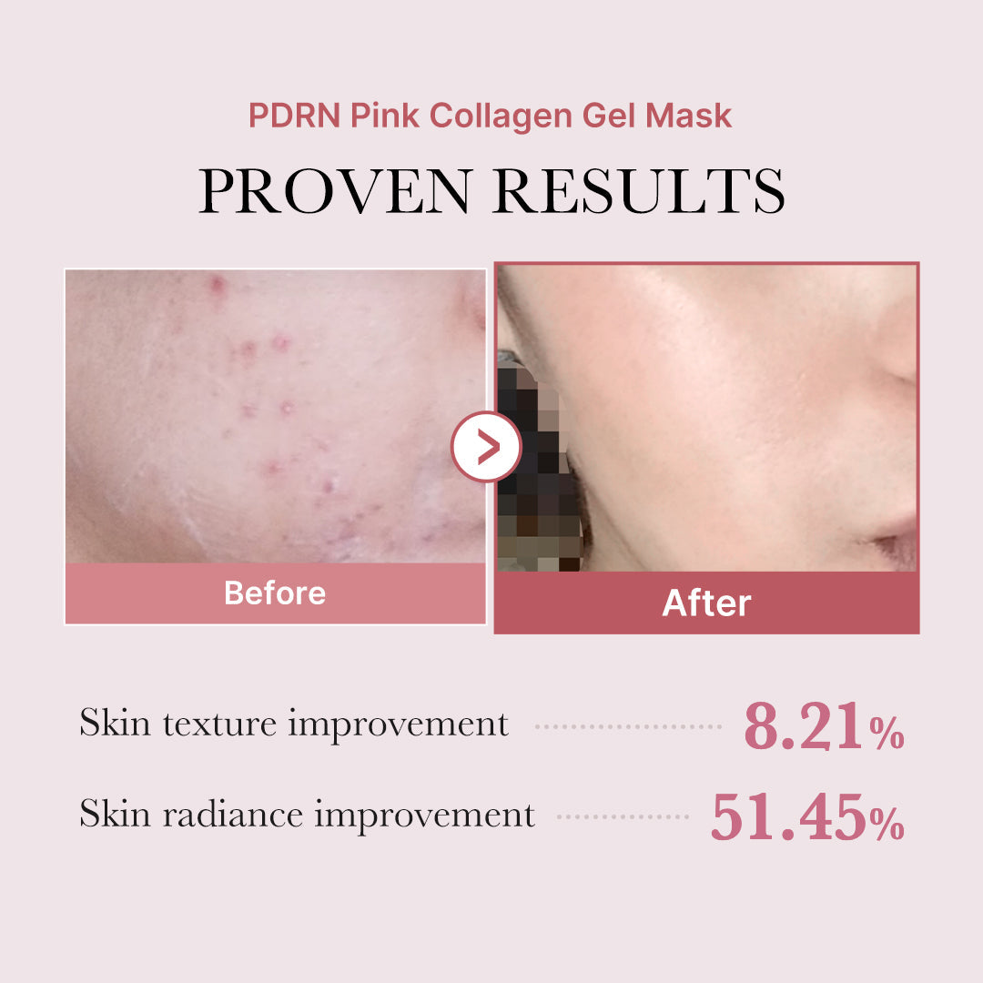 salmon-pdrn-pink-collagen-jelly-gel-mask-t2 PDRN_12.jpg
